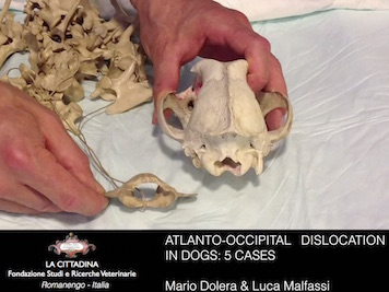 Scopri di più sull'articolo Atlanto Occipital Dislocation